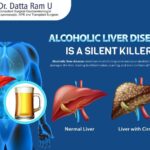 alcoholic liver disease